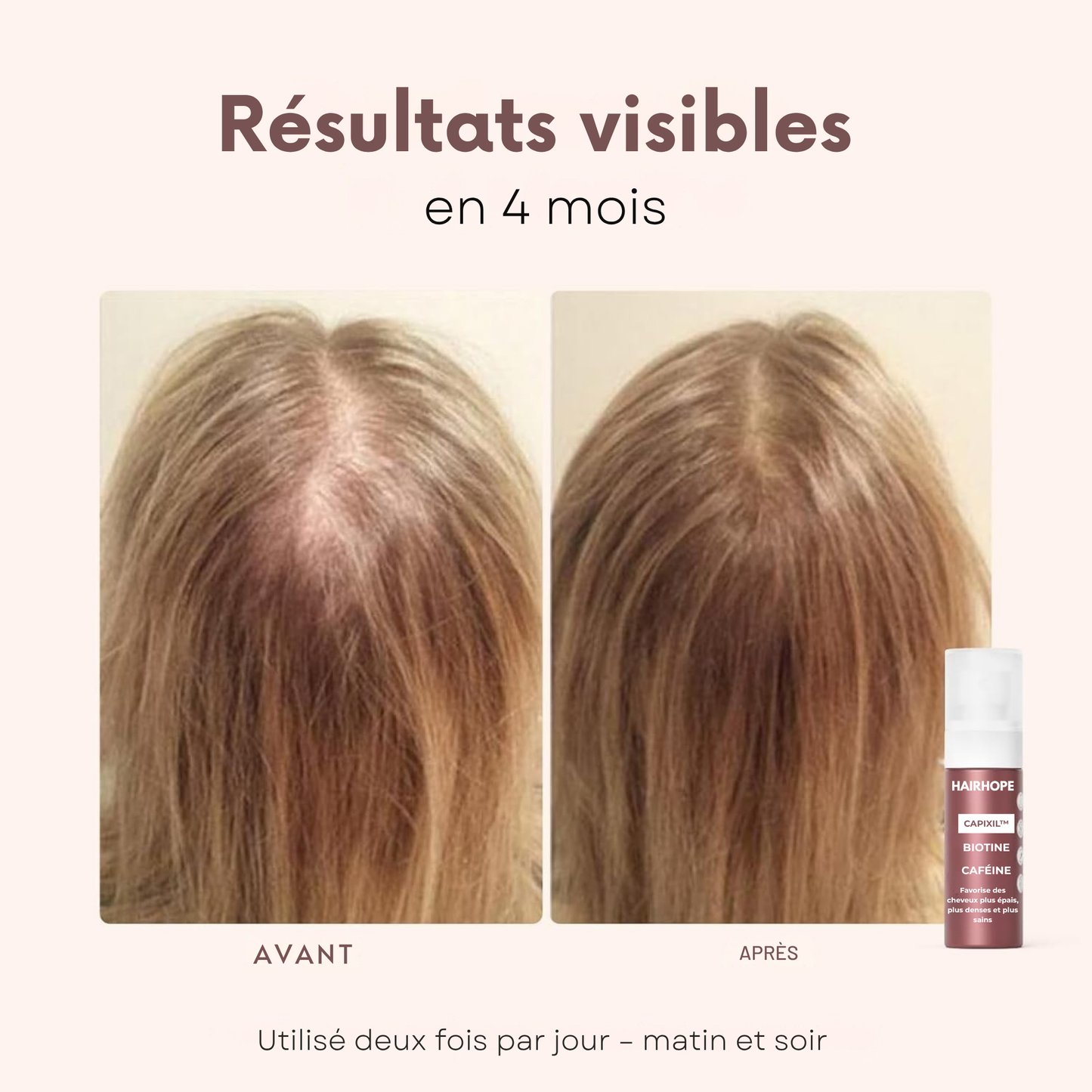 Spray Capillaire HAIRHOPE