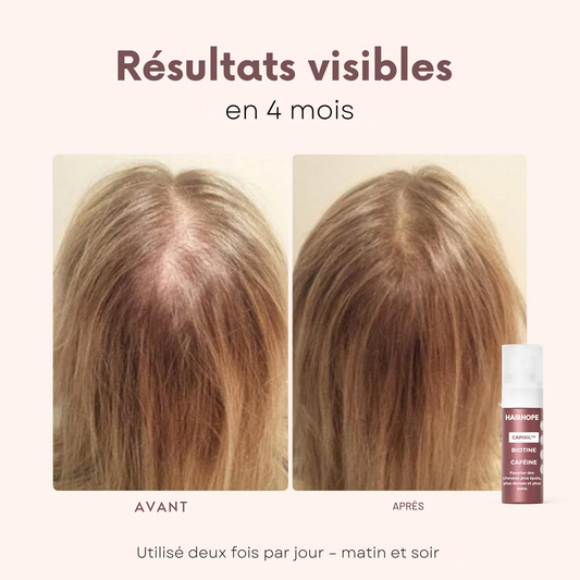 Spray Capillaire HAIRHOPE